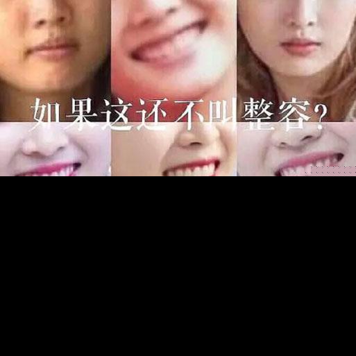 吴宣仪被质疑整容痕迹明显！出道前照片曝光整没整一目了然(图7)